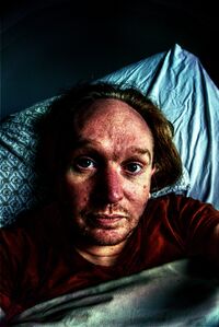 Selfie hdr gulsot no c vitamin for months torture.jpg